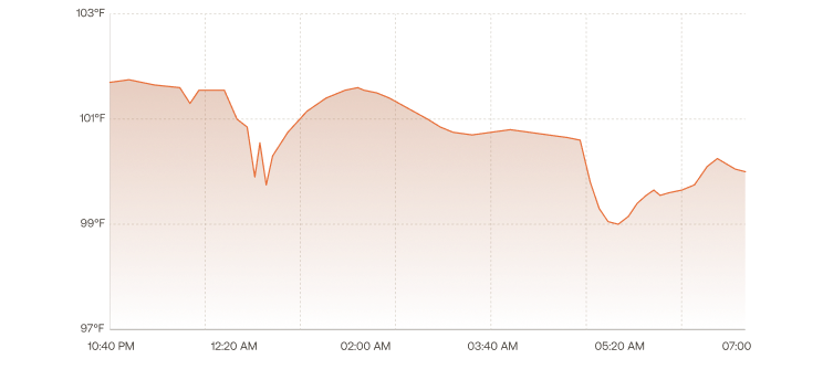 Temperature fluctuations